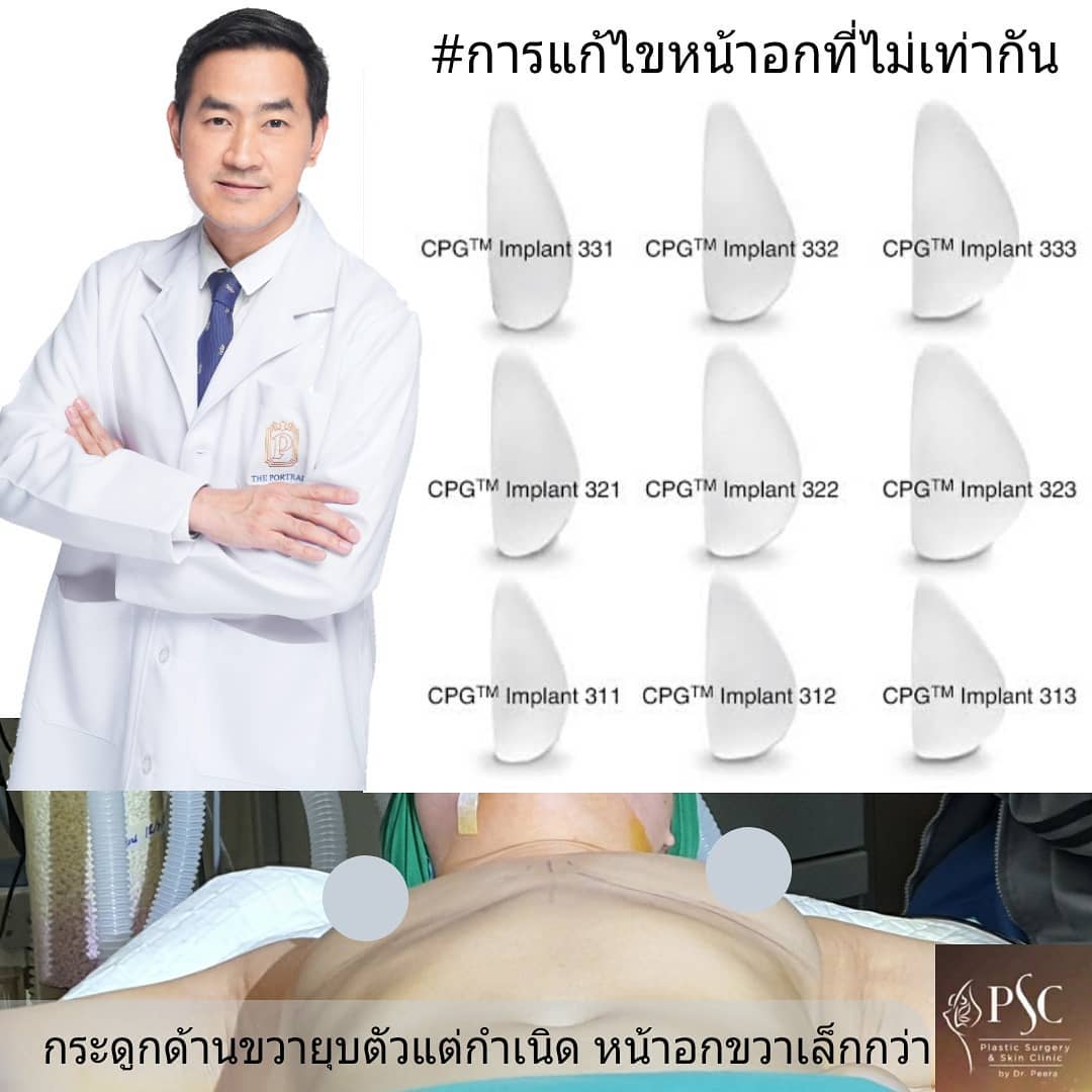 泰国名医志 权威医师皮勒教授攻克乳房重塑、鼻整形难题